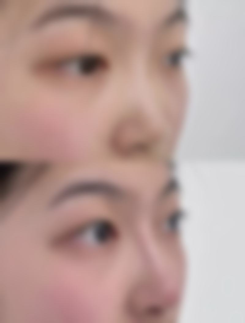 湘潭希美医疗美容门诊部刘艳医生线提升技术怎么样?