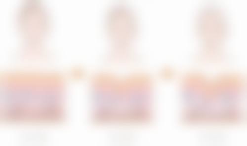 术后眼部护理有哪些建议?