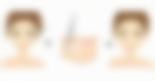 长沙天—医疗整形美容诊所正规吗？