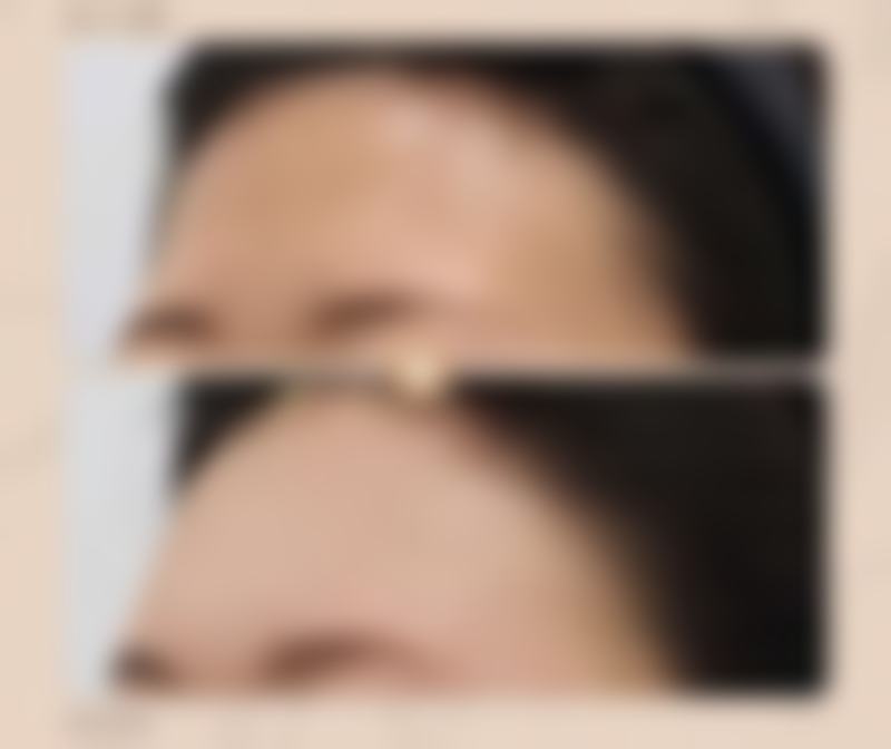 植发有哪些相关细节与有效期有关?