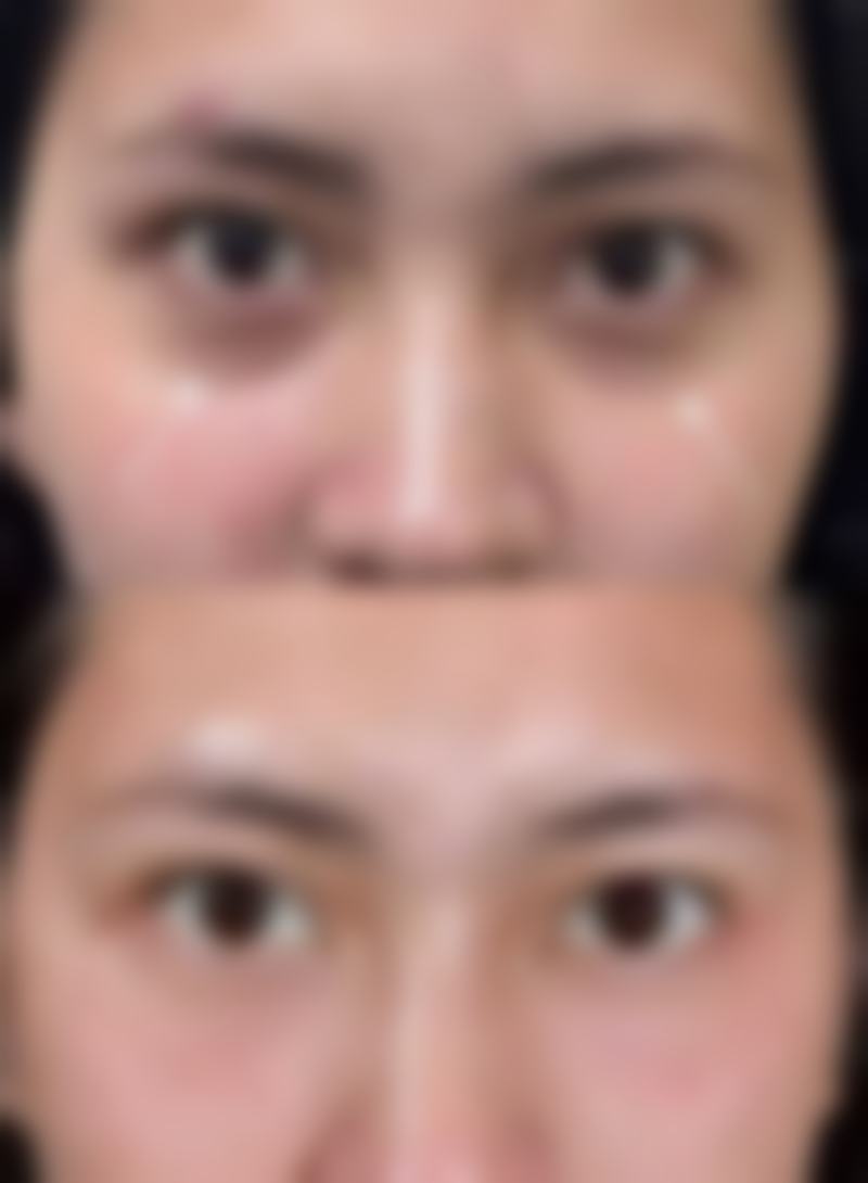 实例五:年龄大、有疾病,成效受影响