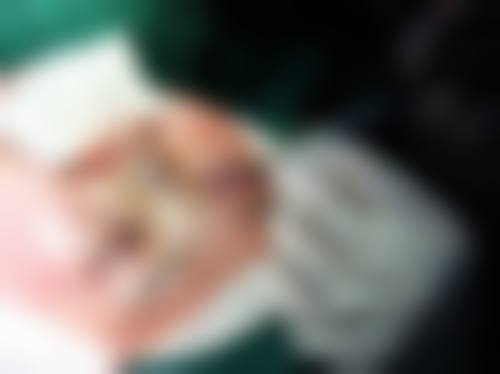 北京美雅枫医疗美容医院李长富医生硅胶隆鼻技术怎么样？