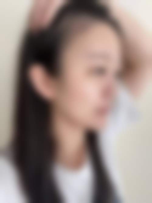 扬州俏华美医疗美容诊所艾莉薇传奇注射微整适合哪些人?