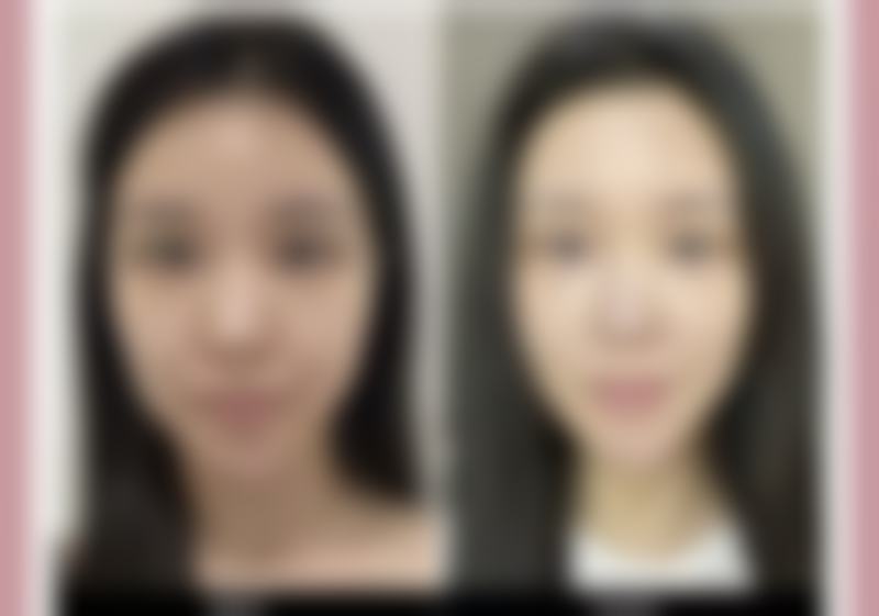 郑州市惠美医疗美容门诊部正规吗?