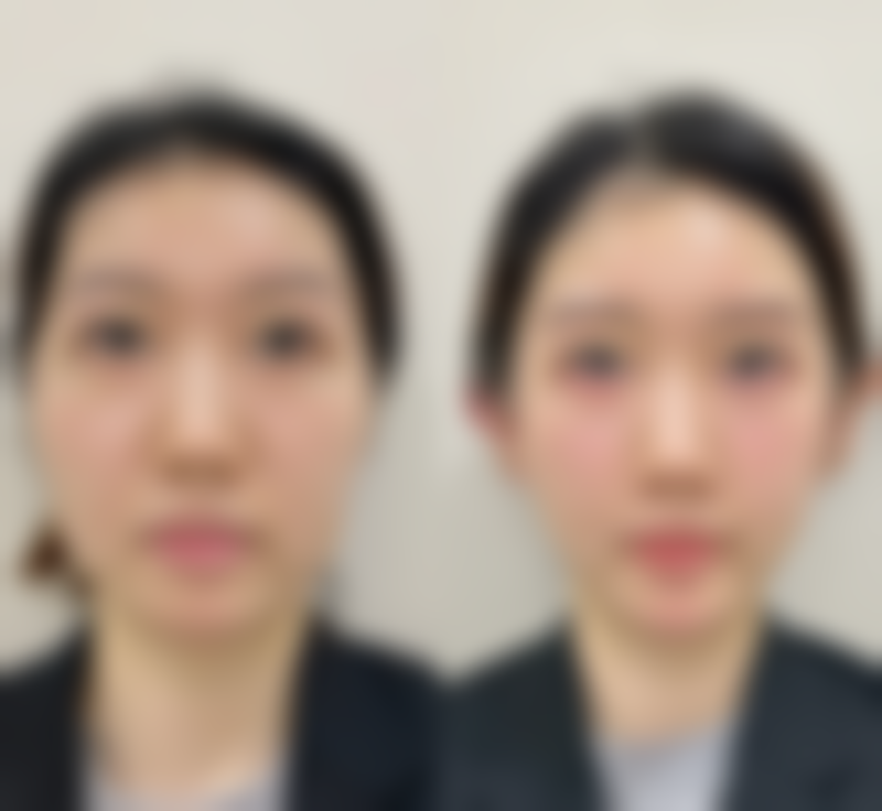 总结