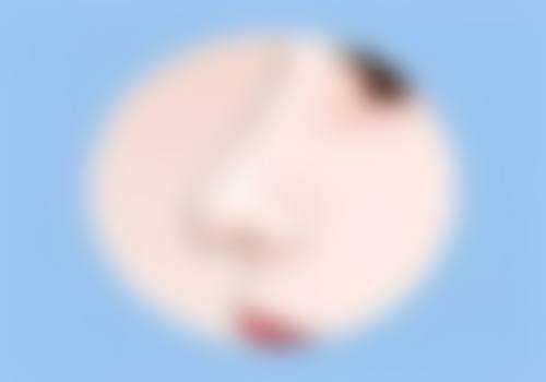 术后1个半月可以正常运动吗？