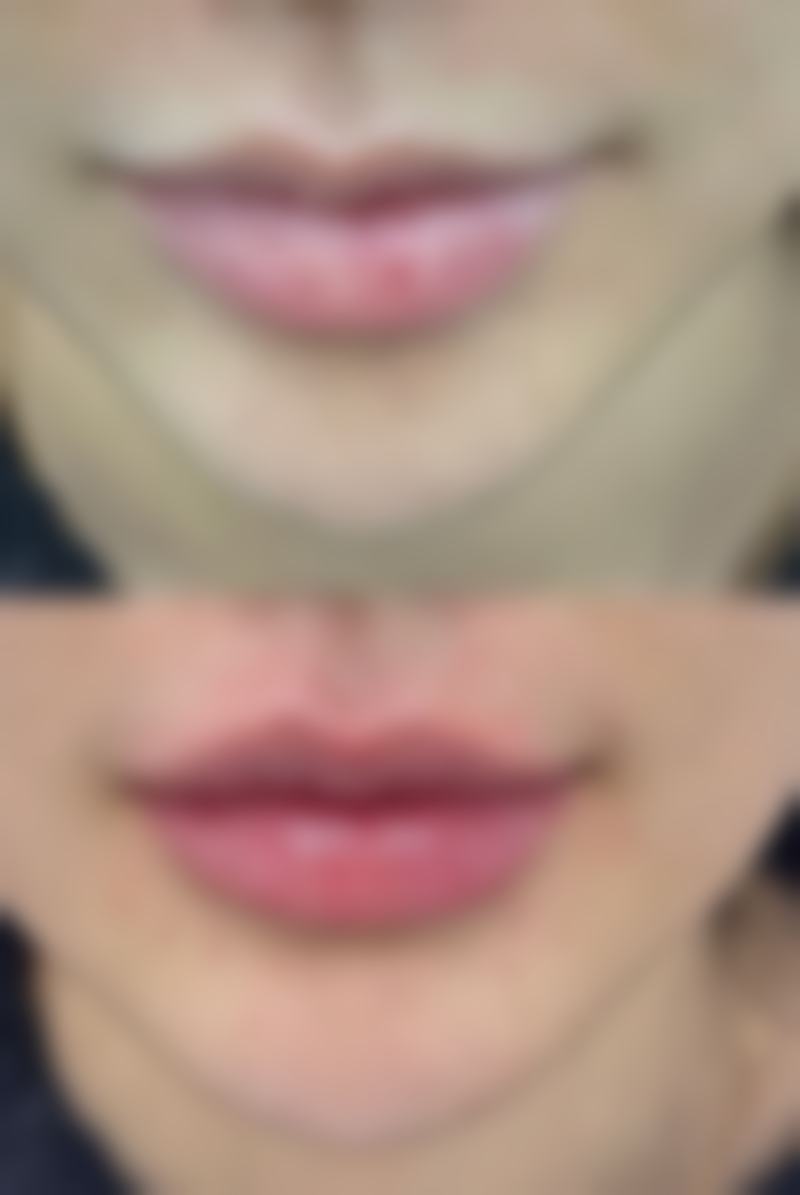 无锡凡千美整形医院口碑评价怎么样?