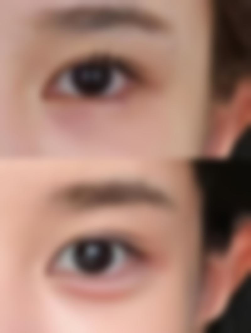 在使用这3步淡化修复法的过程中有什么需要注意的吗?