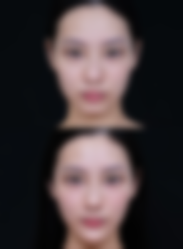 淄博美之元整形美容医院怎么预约