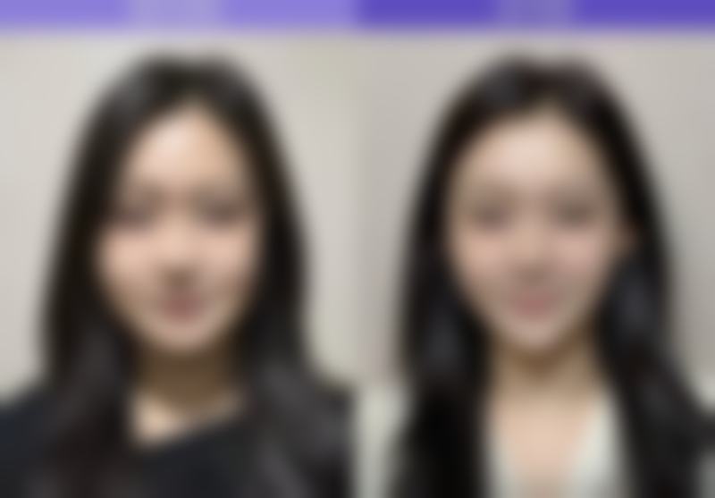 重庆郑荃丽格青春医美门诊部袁菡医生患者评价