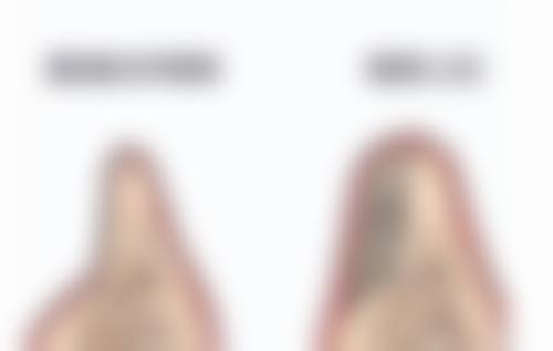 铜陵市人民医院整形美容科钱尼文医生吸脂技术怎么样?