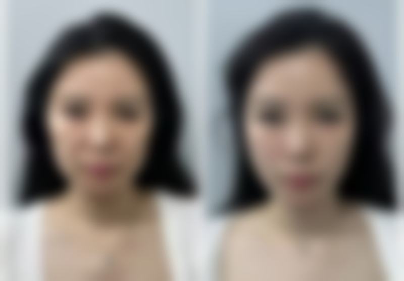 宜昌奥莱整形门诊部怎么预约