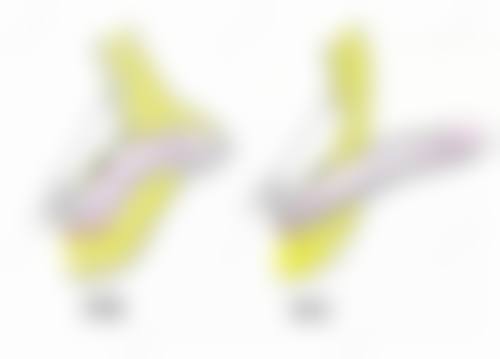 厦门思明瑞麒麟医疗美容诊所清肤泌码胶原是什么?