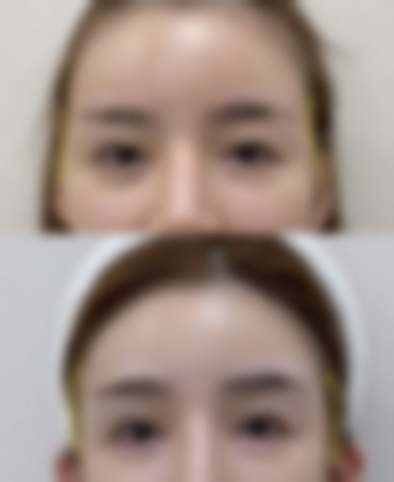 北京韩国完好美容整形医院口碑评价怎么样?