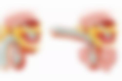 告别熊猫眼!妙招二:注射填充,巧妙填平眼周沟壑