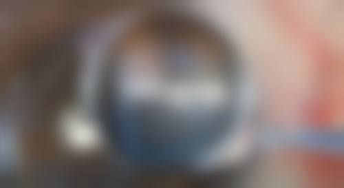 真相三:有哪些修复方法和护理要点?