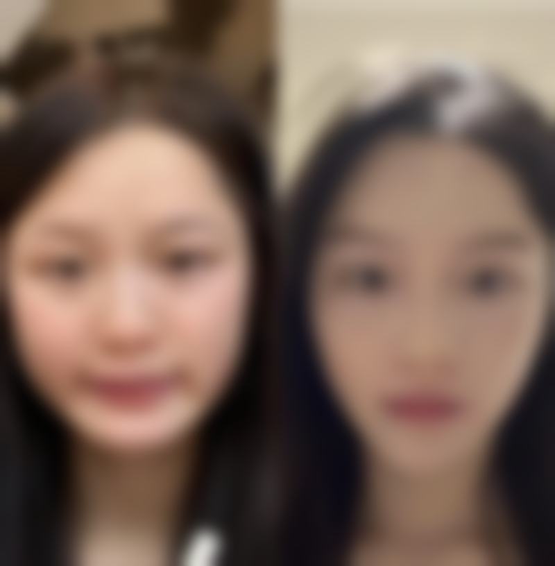 宿州美莱医疗美容门诊成正规吗?
