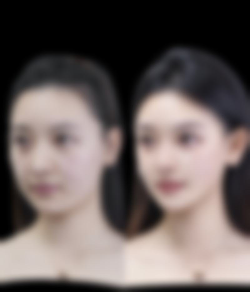 成都青羊鸥罗娜整形医院口碑评价怎么样?