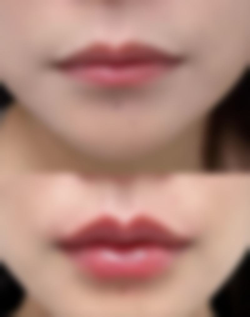 新晃玖悦整形医院正规吗?