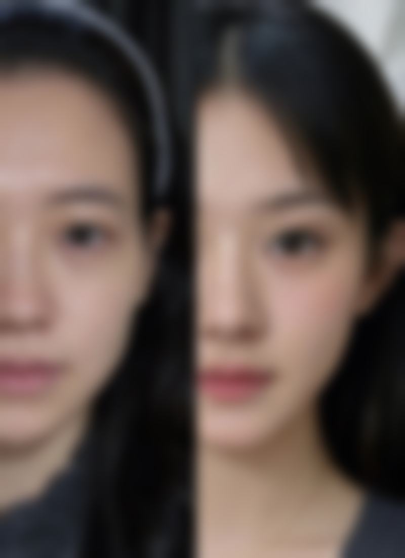 去眼袋手术有哪些风险呢?