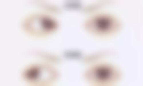 结尾:选择鄂州市中 心医院眼科,拥抱清晰视界
