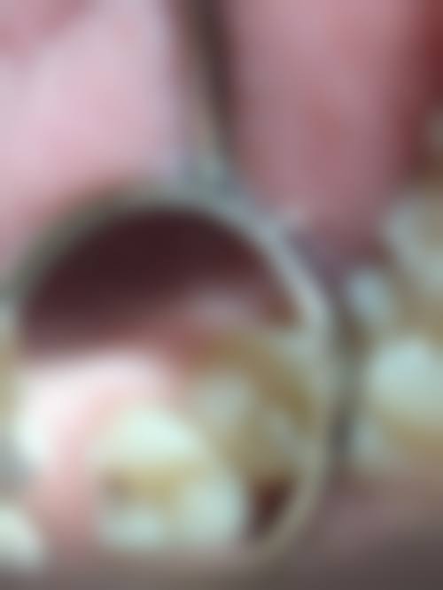 临床实例分享