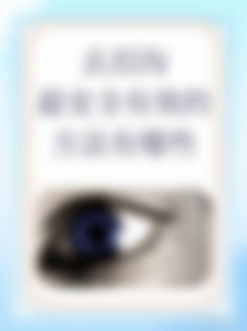 FAQ:常见疑问解答