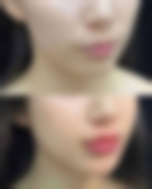 结尾预约号召 施蕾医生 金华浓颜医疗美容诊所