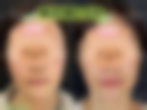 服务流程与患者保护:全程贴心陪伴