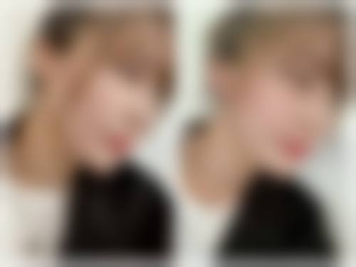 服务流程与理念:从询问到术后全程关怀