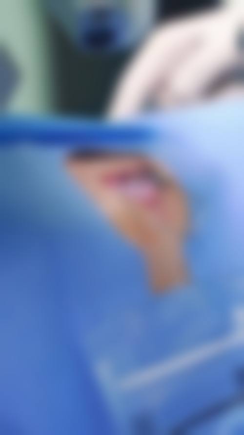 预约优惠活动