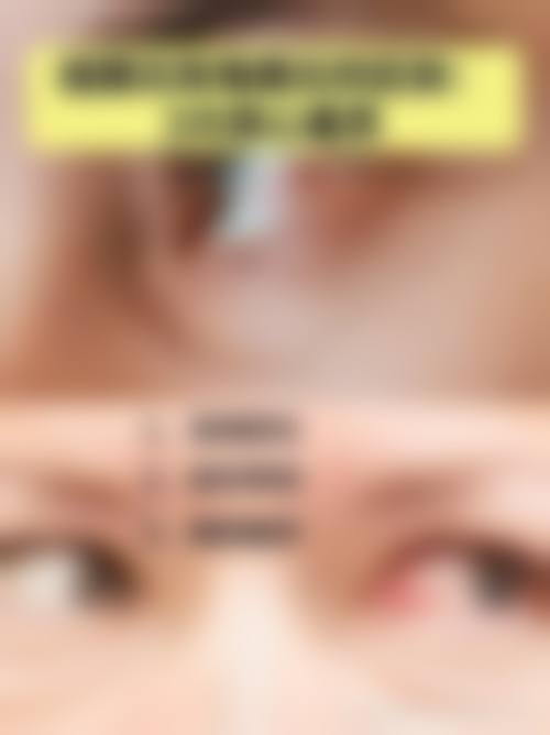 特色诊疗项目：聚焦复杂眼病，覆盖多发病种