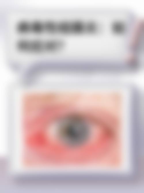 优惠活动详情：原价与优惠价清晰透明