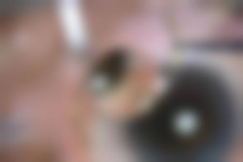 特色科室与项目:覆盖全眼病,个性化治疗