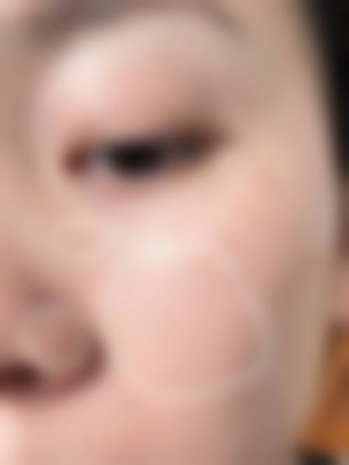 临床实例分享