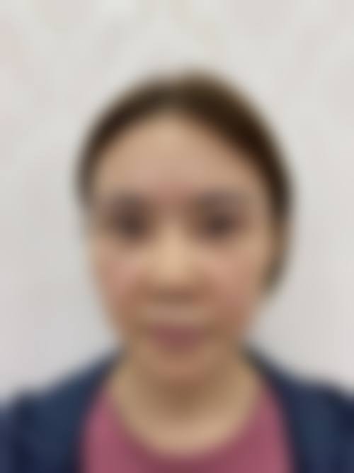 患者真实评价 金华浓颜医疗美容诊所 施蕾医生