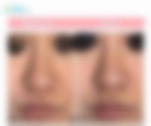 优惠活动详情