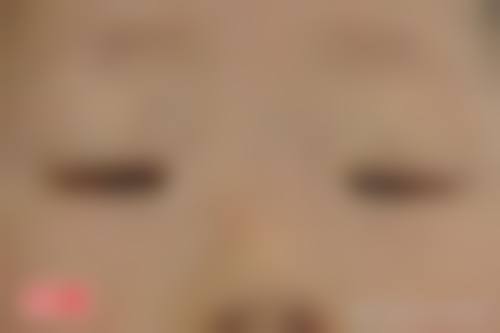优惠活动详情:近视手术原价19800元-优惠价12800元