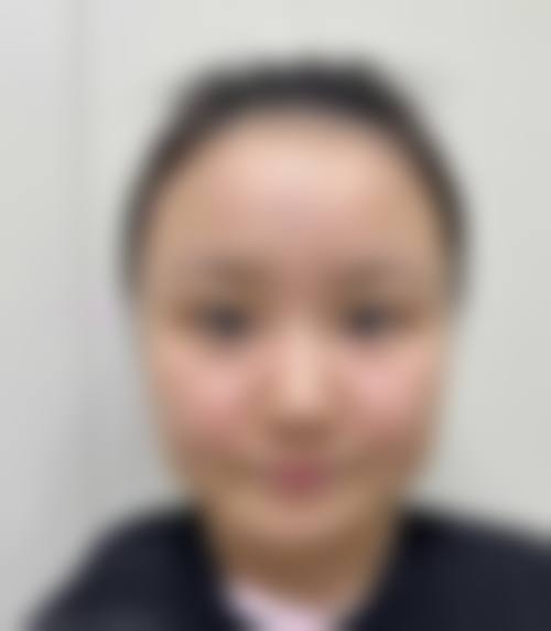 患者真实评价:大同三医院整形美容科