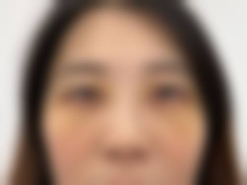 临床实例分享