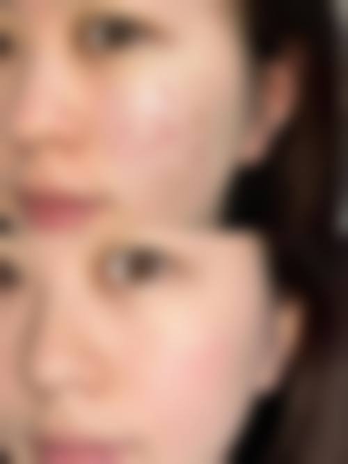 层流手术室与数字化设备环境
