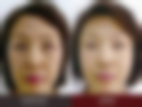 预约优惠活动:张佳医生