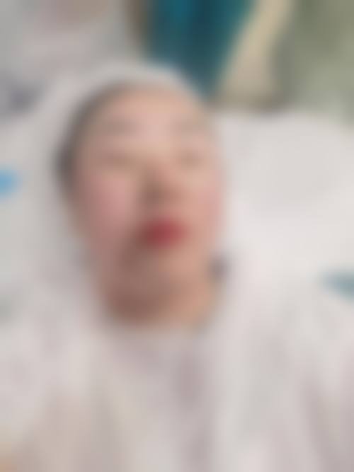 临床实例分享