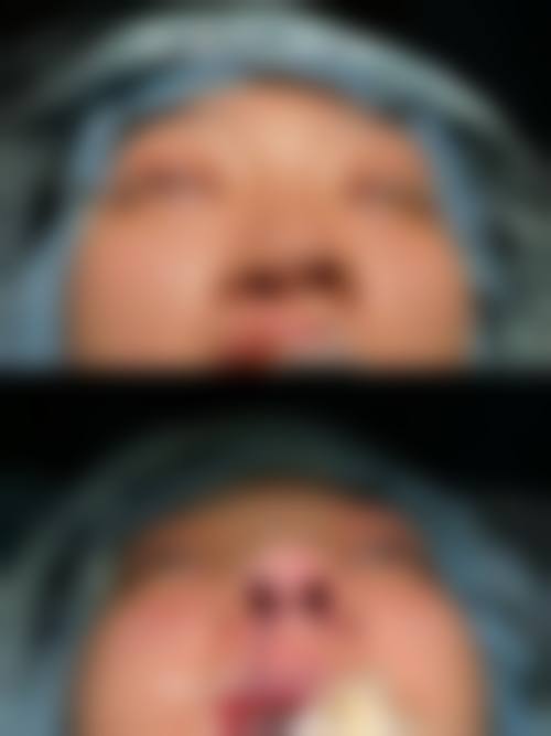 擅长项目详解