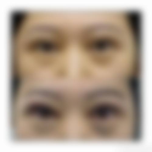 擅长项目详解