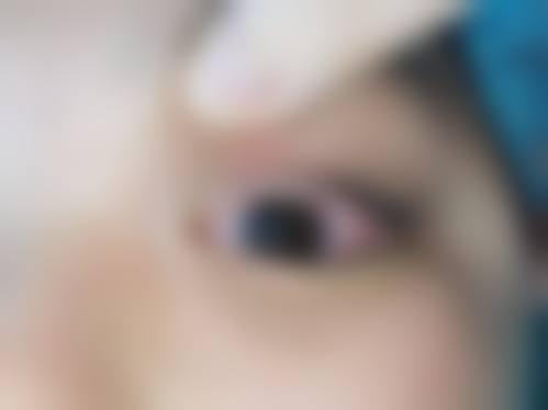 擅长项目详解:江明洁医生能解决我的具体眼病吗?