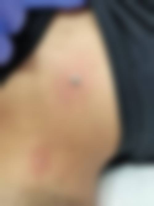 预约优惠活动
