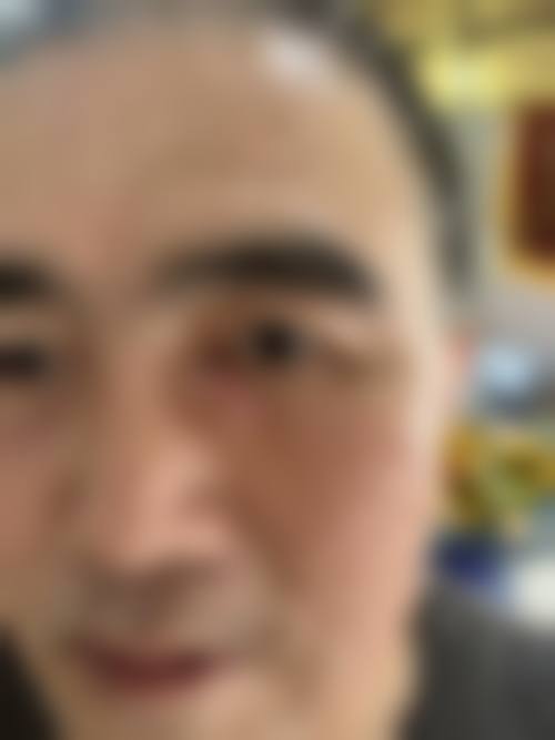 总结:选择正规眼科,安心摘镜