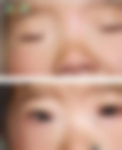FAQ - 焦晋闽 龙岩市第二医院眼科