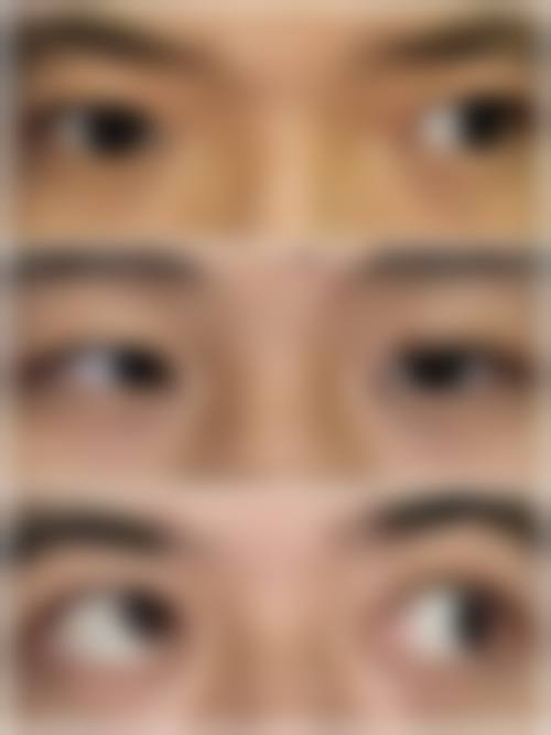 结尾:预约就诊,开启清晰视界